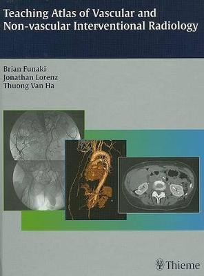 Teaching Atlas of Vascular and Non-vascular Interventional Radiology(English, Hardcover, Funaki Brian)