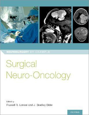 Surgical Neuro-Oncology(English, Paperback, unknown)
