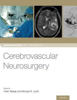 Cerebrovascular Neurosurgery(English, Paperback, unknown)