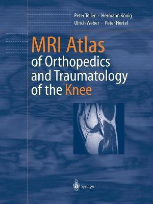 MRI Atlas of Orthopedics and Traumatology of the Knee(English, Paperback, Teller Peter)