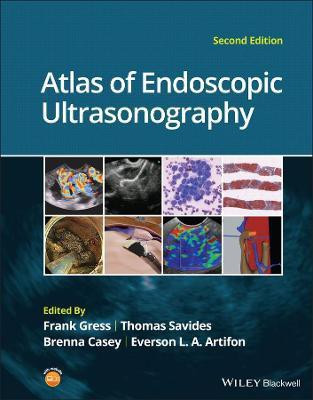 Atlas of Endoscopic Ultrasonography(English, Hardcover, unknown)
