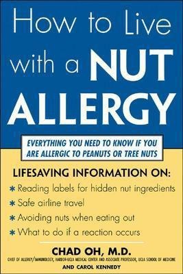 How to Live with a Nut Allergy(English, Electronic book text, Oh Chad)