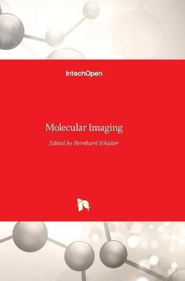 Molecular Imaging(English, Hardcover, unknown)