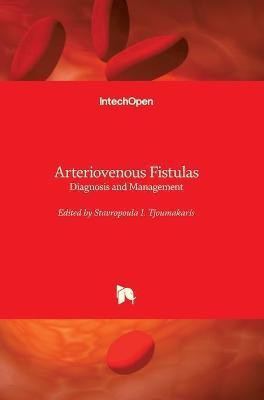 Arteriovenous Fistulas(English, Hardcover, unknown)