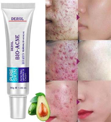 Derol BIO ACNE Removal Cream Gel Anti Acne Scar Treatment Skin