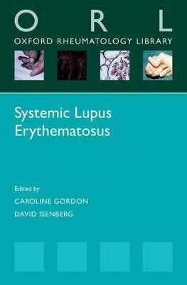 Systemic Lupus Erythematosus(English, Paperback, unknown)