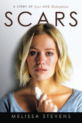 Scars(English, Paperback, Stevens Melissa)