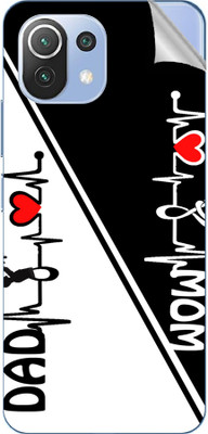 tiddler Xiaomi Mi 11 Lite 5G Mobile Skin(White, Black)