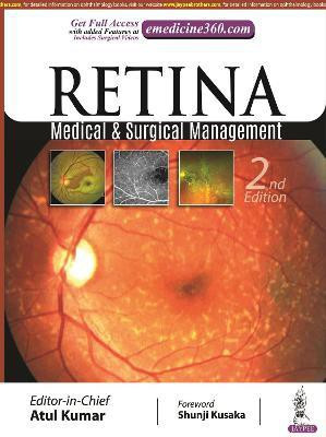 Retina(English, Hardcover, Kumar Atul)