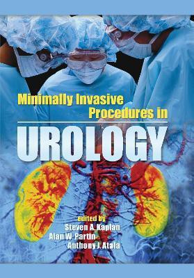 Minimally Invasive Procedures in Urology(English, Hardcover, unknown)