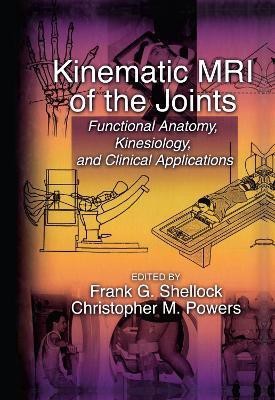 Kinematic MRI of the Joints(English, Hardcover, unknown)