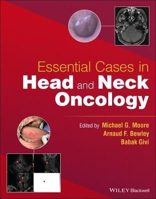 Essential Cases in Head and Neck Oncology(English, Paperback, unknown)