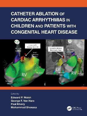 Catheter Ablation of Cardiac Arrhythmias in Children and Patients with Congenital Heart Disease(English, Hardcover, unknown)