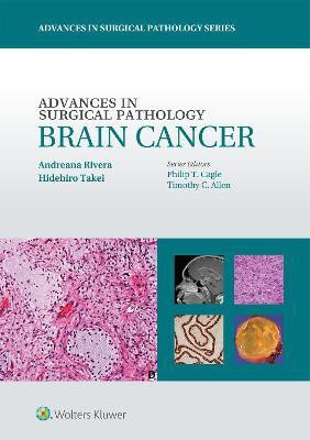 Advances in Surgical Pathology: Brain Cancer(English, Hardcover, Rivera Andreana)