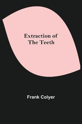 Extraction of the Teeth(English, Paperback, Colyer Frank)