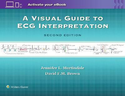 A Visual Guide to ECG Interpretation(English, Paperback, Martindale Jennifer L MD)