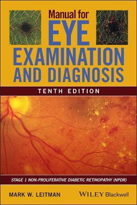 Manual for Eye Examination and Diagnosis(English, Paperback, Leitman Mark W.)