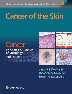 Cancer of the Skin(English, Paperback, DeVita Vincent T Jr. MD)