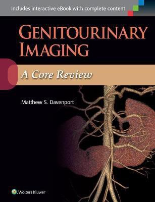 Genitourinary Imaging: A Core Review(English, Paperback, Davenport Matthew S.)