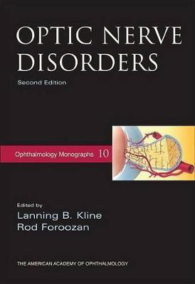 Optic Nerve Disorders(English, Paperback, unknown)