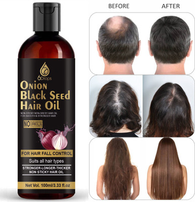 6Drops Onion Hair Oil For Hair Growth And Hair Fall Control with 14 Essential Oils Hair Oil(100 ml)