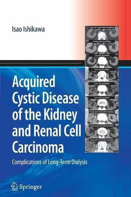 Acquired Cystic Disease of the Kidney and Renal Cell Carcinoma(English, Hardcover, Ishikawa Isao)