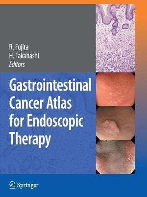 Gastrointestinal Cancer Atlas for Endoscopic Therapy(English, Paperback, unknown)