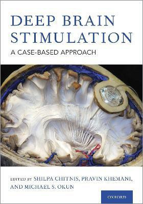 Deep Brain Stimulation(English, Hardcover, unknown)