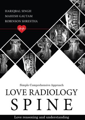 Love Radiology Spine(Paperback, Hariqbal Singh, Mahesh Gautam, Robinson Shrestha)