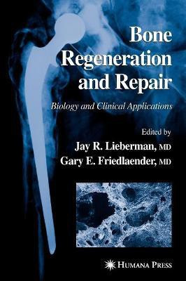 Bone Regeneration and Repair(English, Hardcover, unknown)