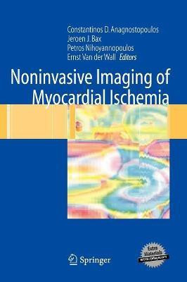 Noninvasive Imaging of Myocardial Ischemia(English, Hardcover, unknown)