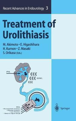 Treatment of Urolithiasis(English, Hardcover, unknown)