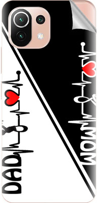 tiddler Xiaomi 11 Lite 5G NE Mobile Skin(White)