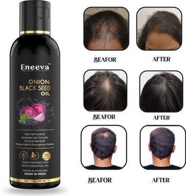 eneeva Onion Blackseed Hair Oil - for Hair Fall Control 100ML Hair Oil(100 ml)