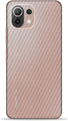 Satisfactory mi 11 lite ne Mobile Skin(Pink)