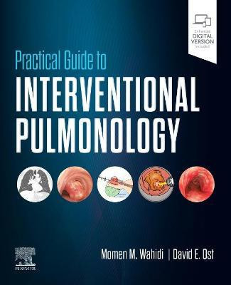 Practical Guide to Interventional Pulmonology(English, Hardcover, unknown)