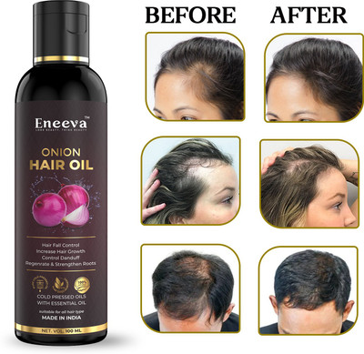 eneeva Onion Hair Oil - Controls Hair Fall - NO Mineral Oil, Silicones, 100 ML Hair Oil(100 ml)