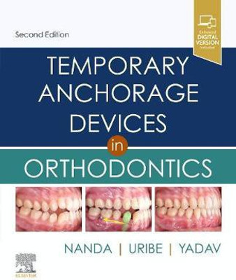 Temporary Anchorage Devices in Orthodontics(English, Hardcover, unknown)