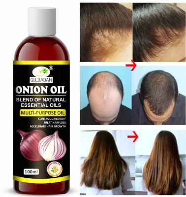 GULBADAN Onion Oil for Hair Regrowth Hair Oil(100 ml)