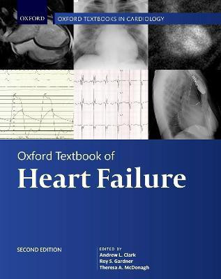 Oxford Textbook of Heart Failure(English, Hardcover, unknown)