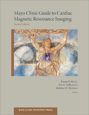 Mayo Clinic Guide to Cardiac Magnetic Resonance Imaging(English, Paperback, McGee Kiaran PhD)