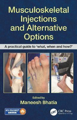 Musculoskeletal Injections and Alternative Options(English, Paperback, unknown)