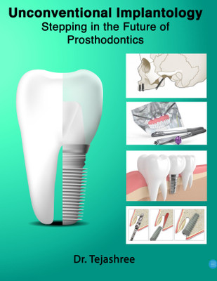 UNCONVENTIONAL IMPLANTOLOGY (STEPPING IN THE FUTURE OF PROSTHODONTICS)(Hardcover, DR. TEJASHREE SUNDEEP KULKARNI)