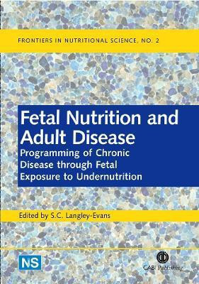 Fetal Nutrition and Adult Disease(English, Hardcover, unknown)