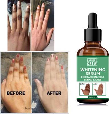 Barbers Crew Fast Action Whitening Serum For Removing Dark Knuckles Elbow and Knee-