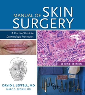 Manual of Skin Surgery: A Practical Guide to Dermatologic Procedures(English, Paperback, Leffell David)