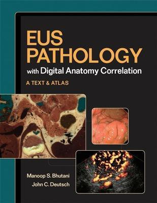 EUS Pathology with Digital Anatomy Correlation 1 Har/Cdr Edition(English, Hardcover, Bhutani Manoop S.)