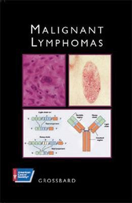 MALIGNANT LYMPHOMAS(English, Hardcover, GROSSBARD)