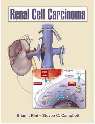 Renal Cell Carcinoma(English, Hardcover, Rini Brian)