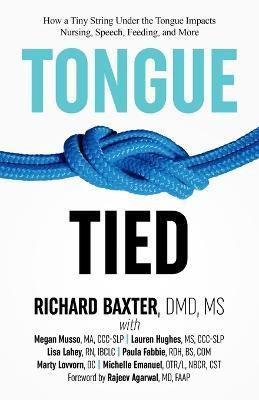 Tongue-Tied(English, Paperback, Baxter DMD Richard MS)